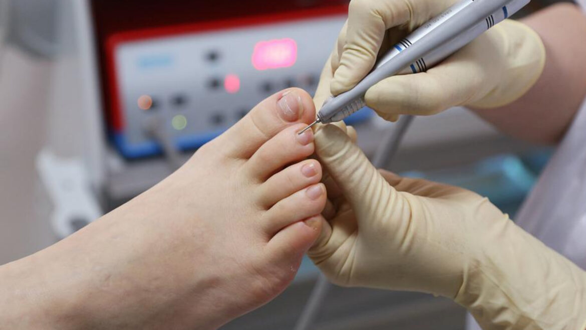 The most effective method to Manage Chronic Foot Pain with the Help of a Podiatrist Clinic